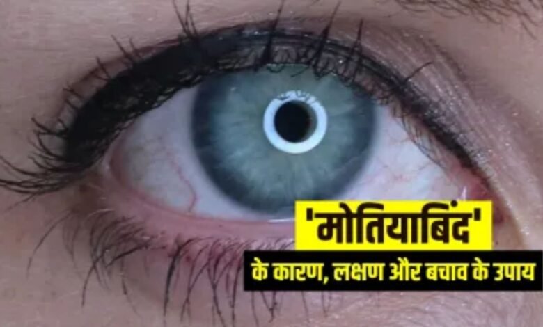 Tips for Cataract
