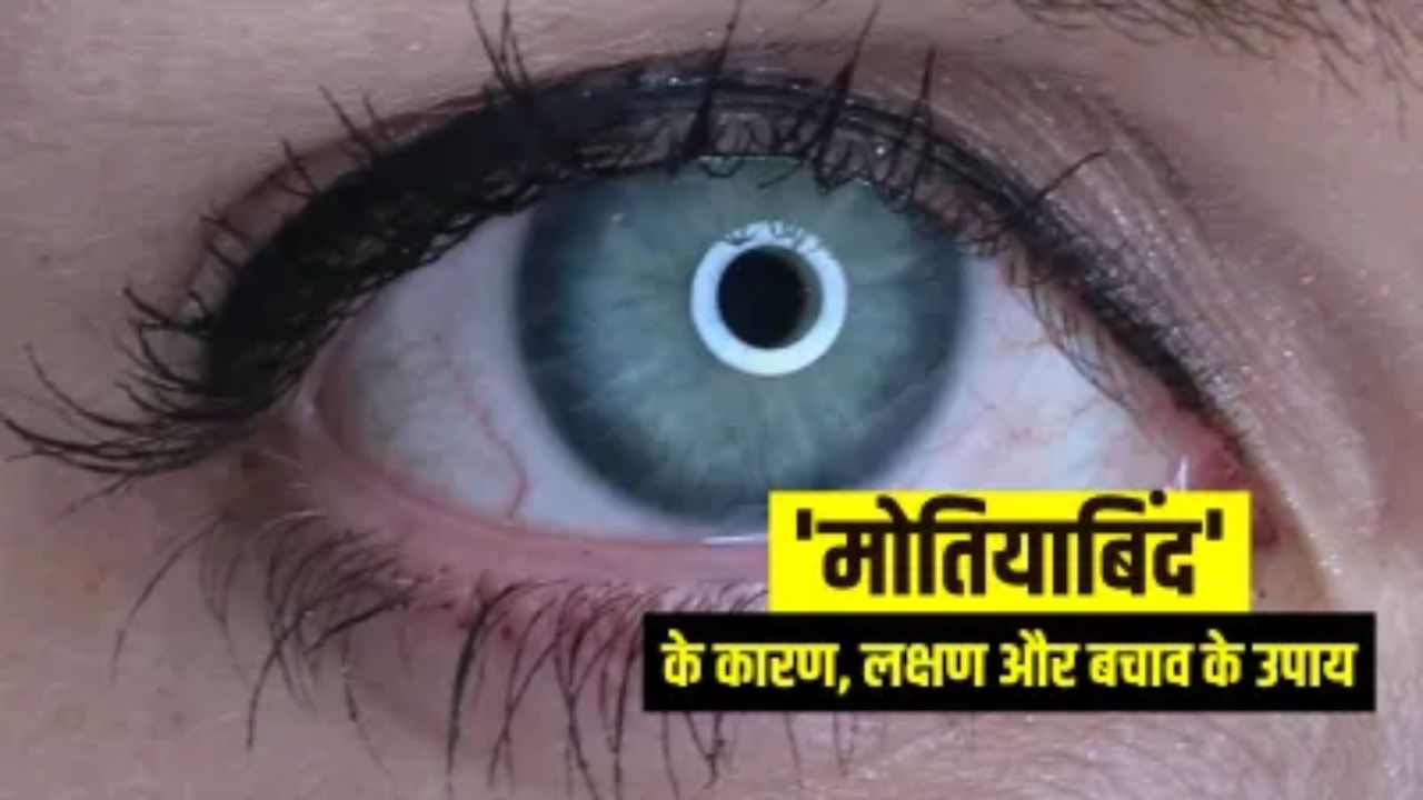 Tips for Cataract: धुंधली नजर हो गई है? हो सकते हैं मोतियाबिंद के शुरुआती संकेत, जानें डॉक्टर क्या कहते हैं? Tips for Cataract