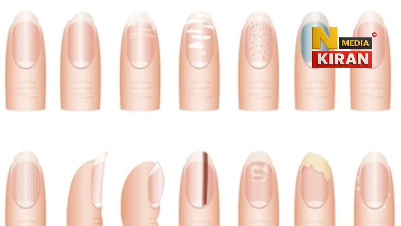 Nail Health