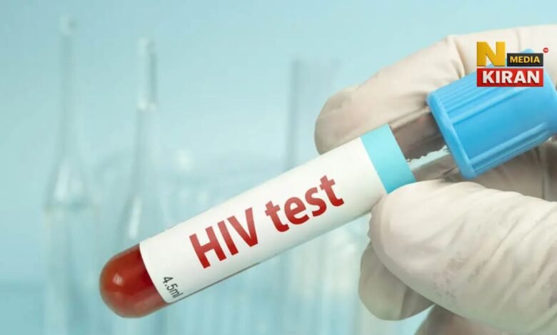 HIV Ke Lakshan