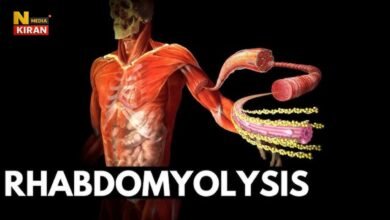 Rhabdomyolysis