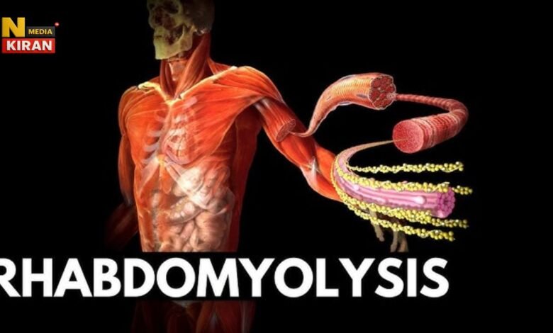 Rhabdomyolysis