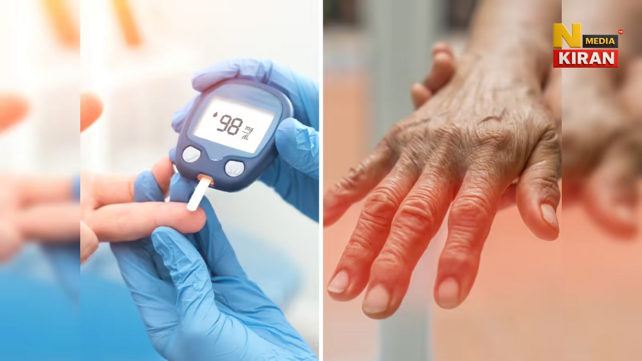 Diabetic Neuropathy