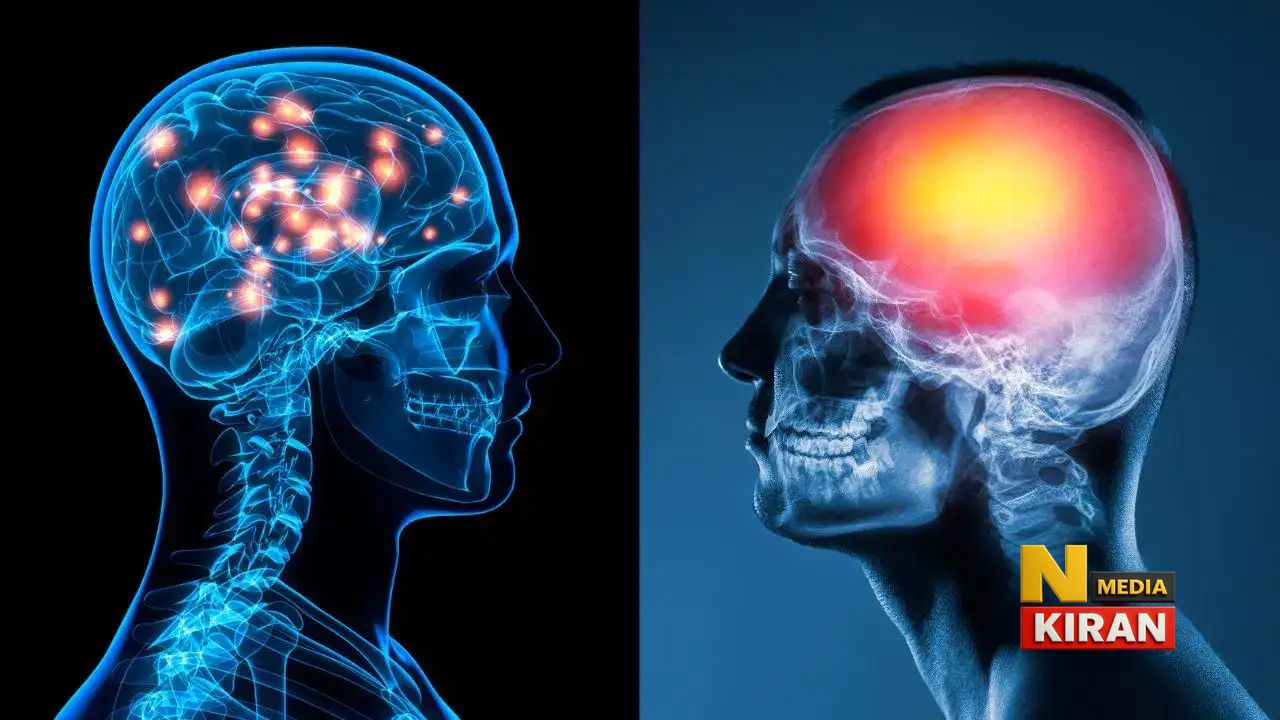 दिमाग की थकान: जब ब्रेन भी ‘रिस्टार्ट’ मांगता है दिमाग की थकान: जब ब्रेन भी ‘रिस्टार्ट’ मांगता है