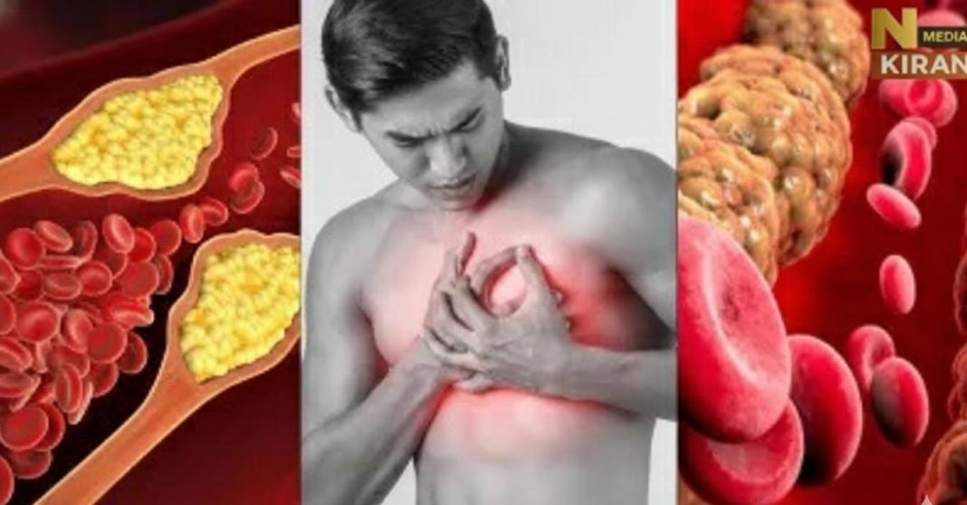 कोलेस्ट्रॉल और ट्रायग्लिसराइड: जानें कौन बढ़ाता है हार्ट अटैक का खतरा