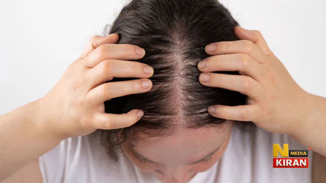 Foods Which Cause Hair Fall