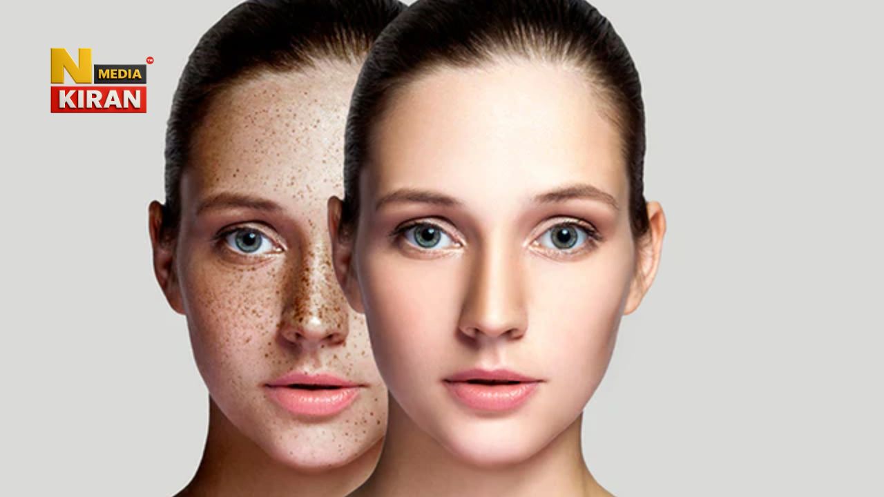 Castor Oil For Skin: Get rid of blemishes and pimples