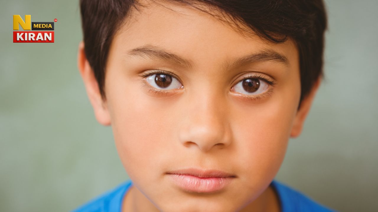 Birthmark on the cheek of a boy
