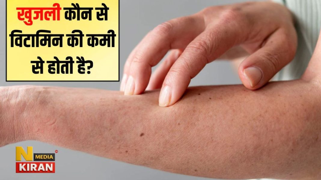 What Vitamin Deficiency Makes You Itch: शरीर में खुजली मामूली परेशानी या विटामिन की कमी का संकेत?