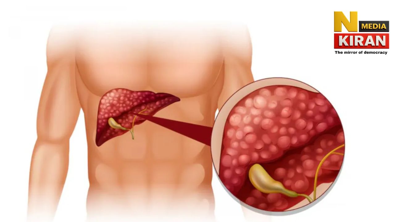 Fatty Liver Reason